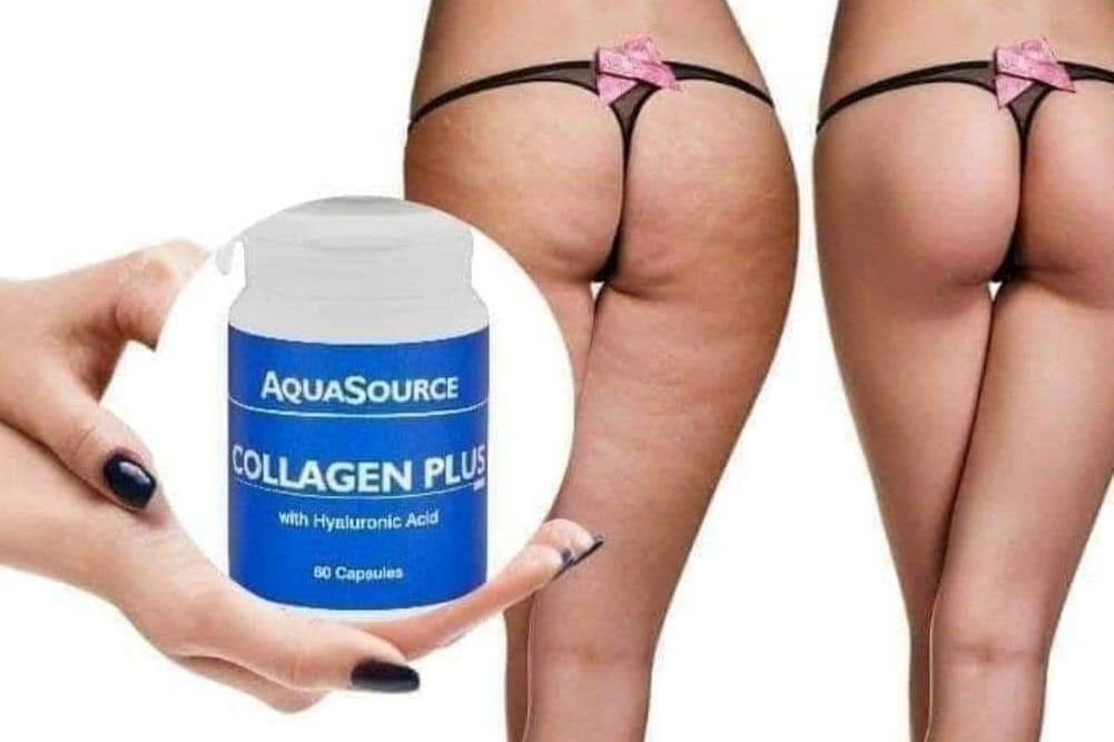 Lack of collagen